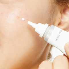 كوسركس - كريم ألتيميت سبوت إزالة الآثار والتصبغات 30 جم