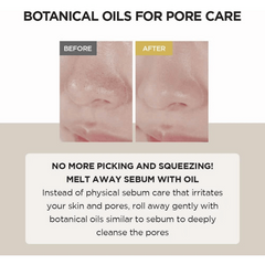 سكين 1004 - غسول زيتي لتنظيف البشرة والمسام بخلاصة السنتيلا 200مل