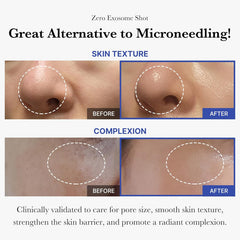 ميديكيوب - امبولة اكسوسوم 75500 لتعزيز اصلاح البشرة البشرة وتضييق المسام 30 مل