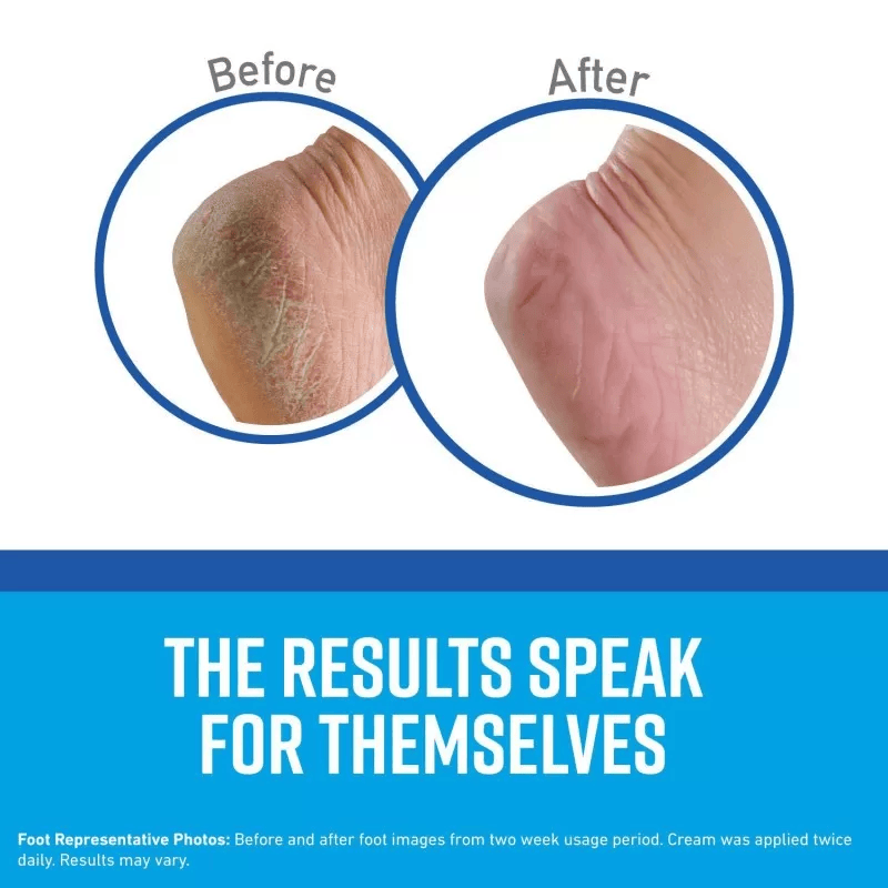 اوكيفس - كريم لصحة القدمين 198 جم