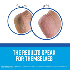 اوكيفس - كريم لصحة القدمين 198 جم