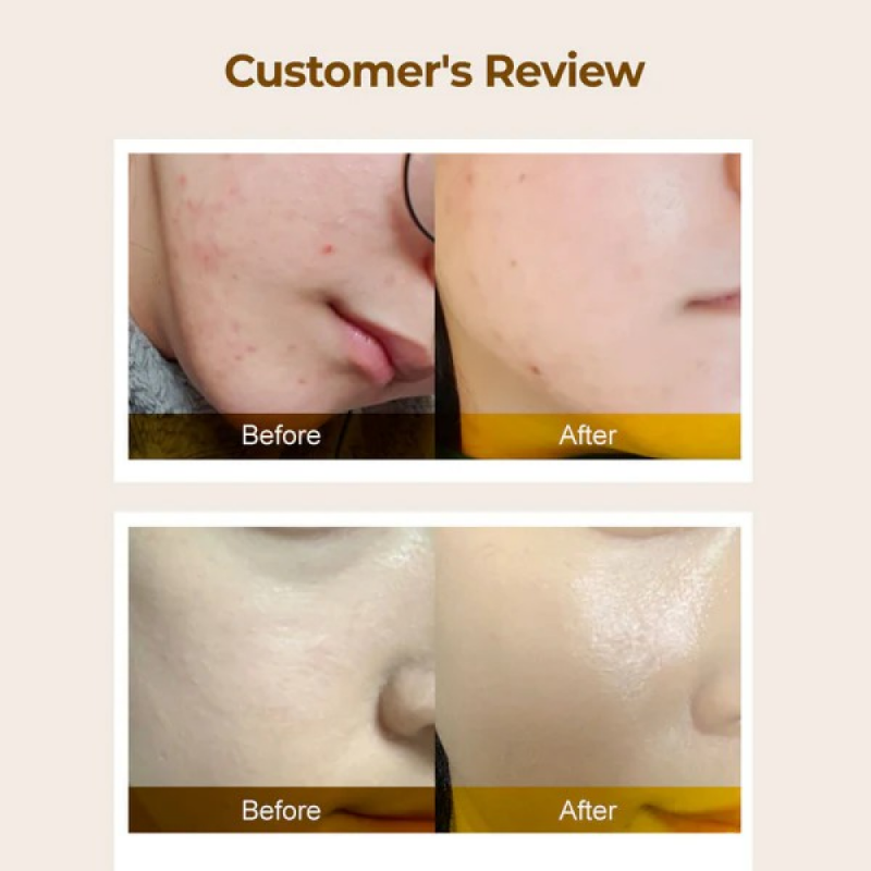 نومبوزين‏ - تونر 3 التوهج الفائق للبشرة 200 مل