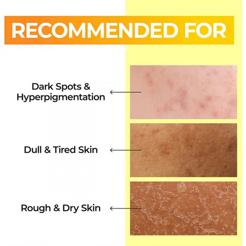 نومبوزين‏ - تونر 5 المعزز بالفيتامينات الأساسية 200 مل